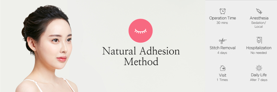 Natural Adhesion Method operation time - 30 mins / Anesthesia - sedation / Stitch Removal - No needed / Hospitalization - No needed / Visit - 1 time / Daily Life - After 3~4 days