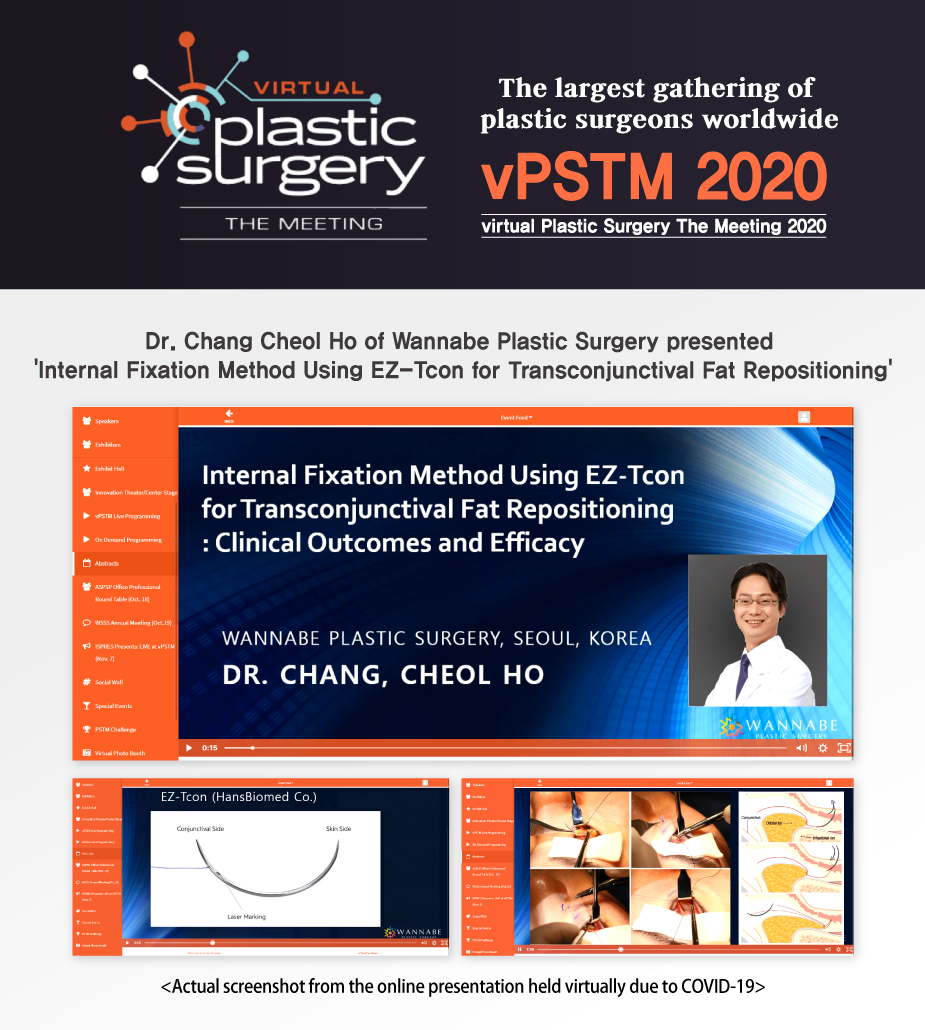 virtual Plastic Surgery The Meeting 2020, vPSTM 2020