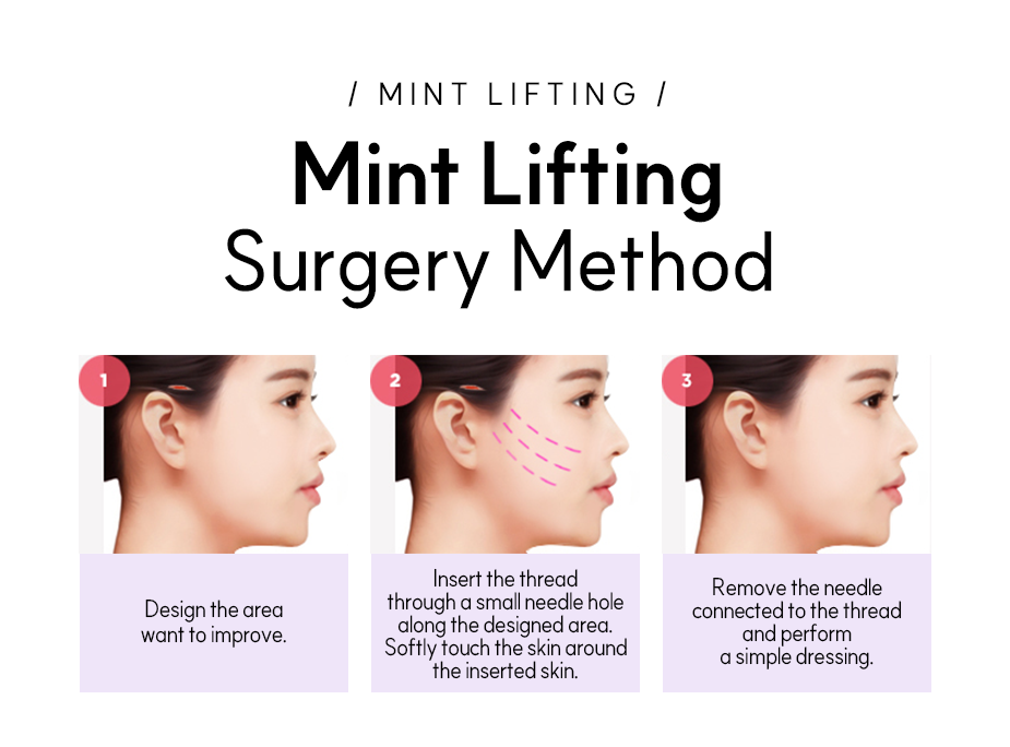 Mint Lifting Surgery Method - 1.Design the area want to improve. 2.Insert the thread through a small needle hole along the designed area. Softly touch the skin around the inserted skin. 3.Remove the needle conneted to the thread and perform a simple dressing.